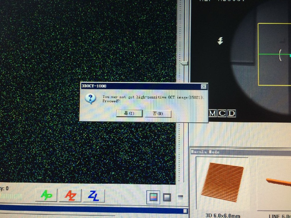 拓普康 OCT-1000 故障15021