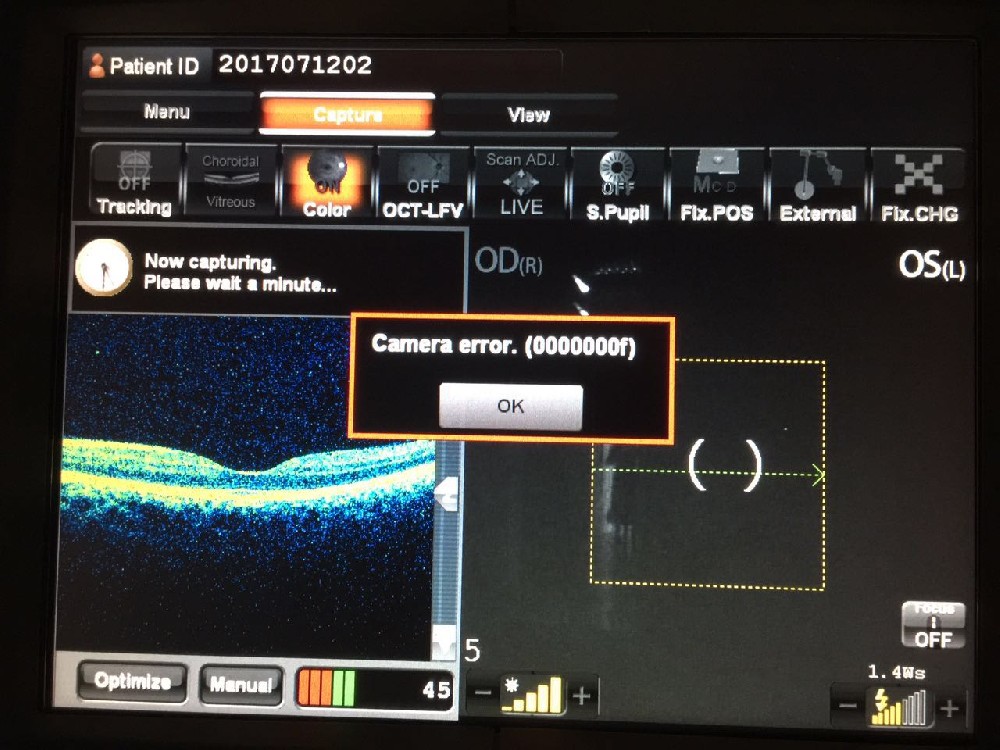 拓普康 OCT-2000 故障000000f